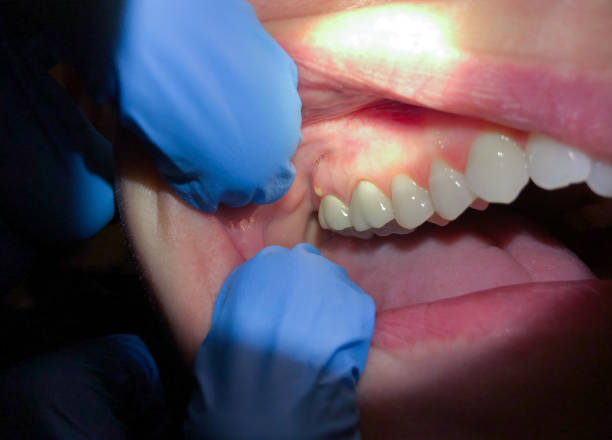 Best Emergency Treatment for Toothache in Danville, KY