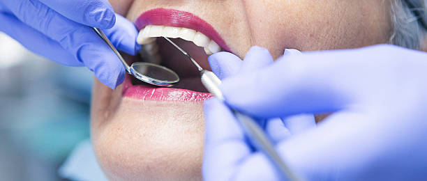 Best Emergency Broken Tooth Repair in Danville, KY